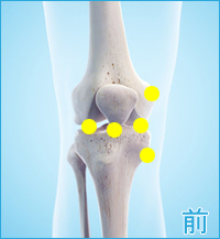 膝の前側の痛み（内側側副靭帯,膝蓋靭帯,内側半月板,外側半月板）