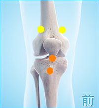 変形性膝関節症の膝の痛み
