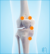 変形性膝関節症の膝の痛み前