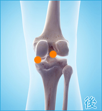 変形性膝関節症の膝の痛み後ろ