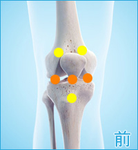 膝の前側の痛み（膝蓋靭帯の痛み,膝蓋骨の痛み,関節の痛み）