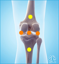 膝の後ろ側の痛み（後十字靭帯損傷の合併症の痛み）