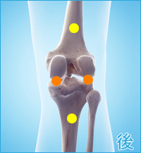 前十字靭帯損傷の膝の後ろ側の痛み