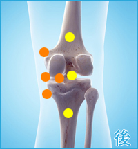 膝の後ろの痛み（内側側副靭帯損傷をかばった膝の痛み）
