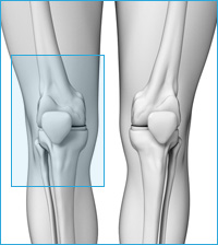 医療用の後十字靭帯用膝サポーター｜膝の前側の痛み