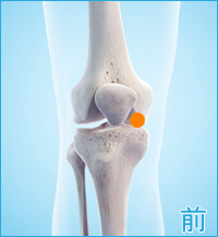 変形性膝関節症の膝の前側の痛み