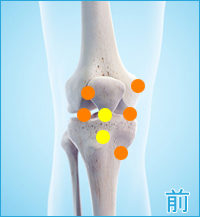 膝の前の痛み（離断性骨軟骨炎、膝蓋軟骨軟化症）