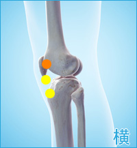 膝の横の痛み（ランナー膝の痛み・膝蓋腱炎）