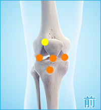 膝の痛み（内側半月板、膝蓋靭帯、膝蓋骨軟化症）