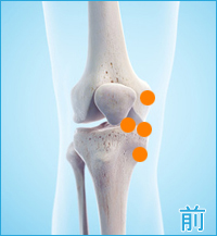 膝の前側の痛み（内側側副靭帯,内側半月板）