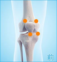 前十字靭帯損傷の膝の前側の痛み