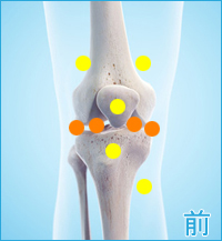 医療用の後十字靭帯用膝サポーター｜膝の前側の痛み（後十字靭帯損傷の合併症）