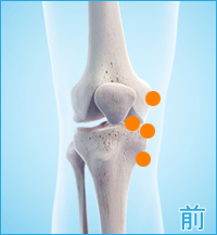 膝の前側の痛み（内側側副靭帯損傷,内側半月板損傷）
