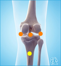 膝の後側の痛み（膝蓋靭帯の痛み,膝蓋骨の痛み,関節の痛み）