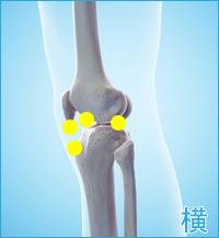 膝の外側の痛み（前十字靭帯,後十字靭帯,膝蓋靭帯）