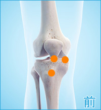 膝の前側の痛み（膝蓋大腿関節症,ジャンプ膝,膝蓋靭帯炎）