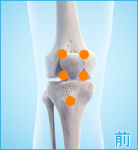 膝の前側の痛み（膝蓋靭帯の痛み,膝蓋骨の痛み,関節の痛み）