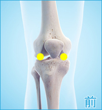 前十字靭帯損傷の膝の痛み