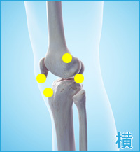 膝の外側の痛み（ランナー膝）