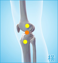 膝の痛み3