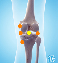 膝の痛み（内側側副靭帯損傷,内側半月板損傷,外側半月板損傷）