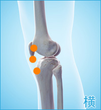 膝の痛み（膝蓋靭帯、膝蓋骨軟化症）