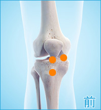 膝の前側の痛み（膝蓋大腿関節症,変形性膝関節症,膝蓋靭帯炎）
