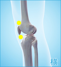 前十字靭帯損傷の膝の横の痛み