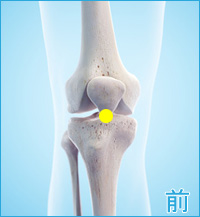 ベーカー嚢腫の膝の前側の痛み
