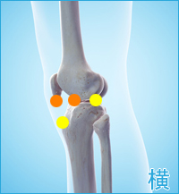 膝の横の痛み（前十字靭帯,後十字靭帯）