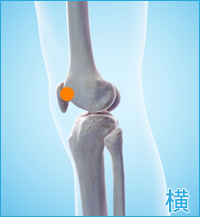 膝の痛み3